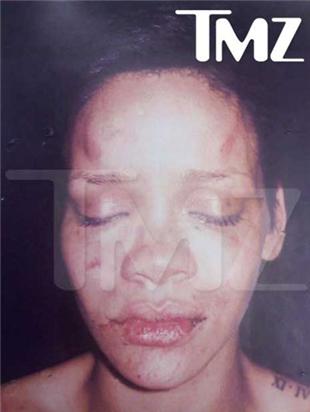 rihanna pictures after beating. Rihanna after Chris Brown#39;s